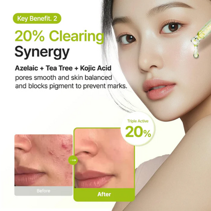 Purito Azelaic Acid Serum — packaging detail