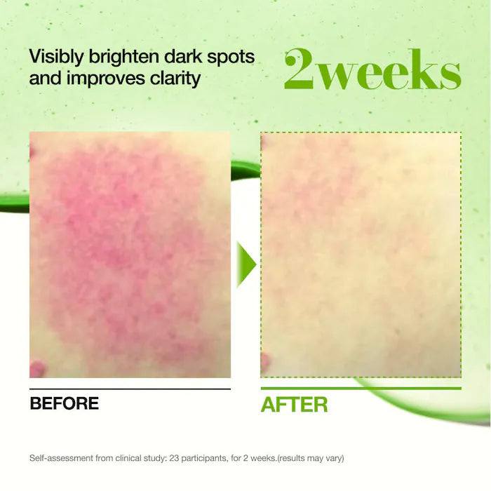 Anua Azelaic Acid Serum — packaging detail